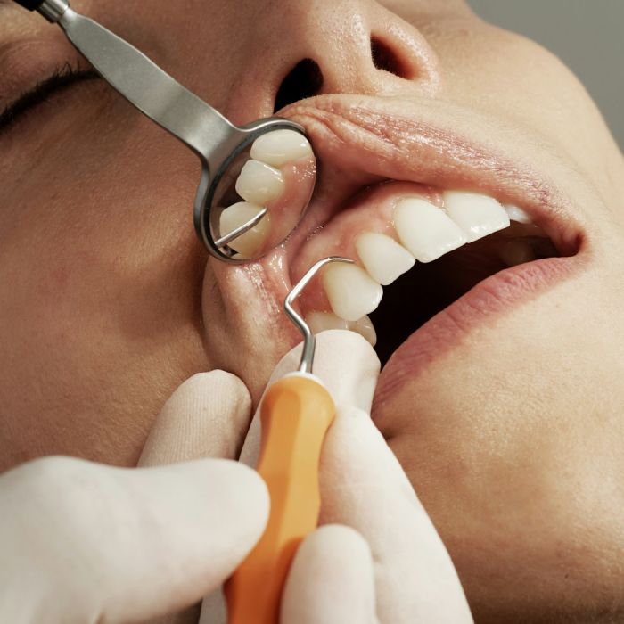 Gencives qui saignent au brossage : faut-il consulter ?